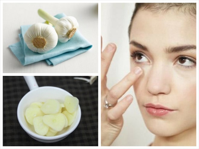 Một số công dụng đặc biệt của tỏi mà ít ai biết